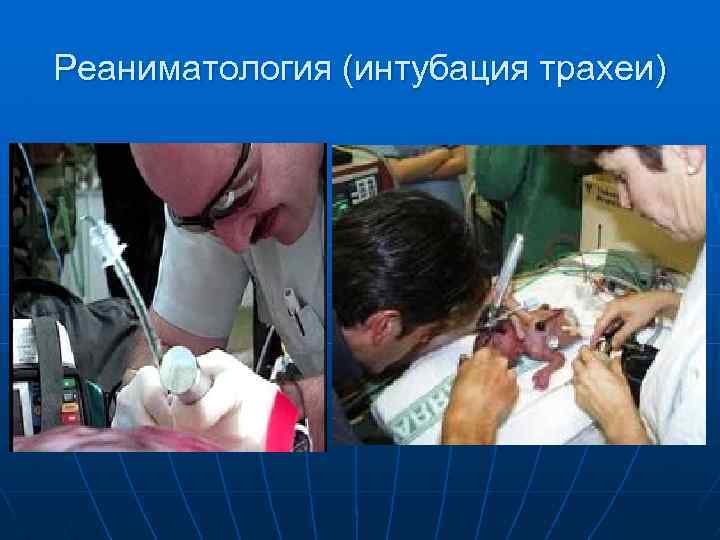 Реаниматология (интубация трахеи) 