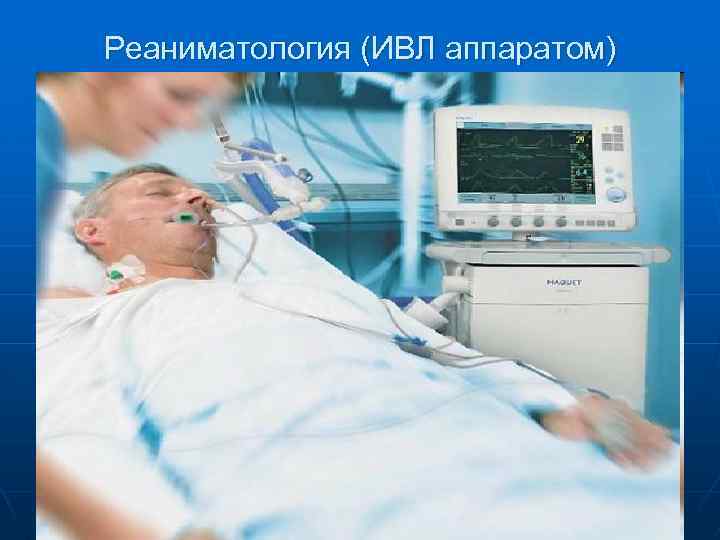 Реаниматология (ИВЛ аппаратом) 