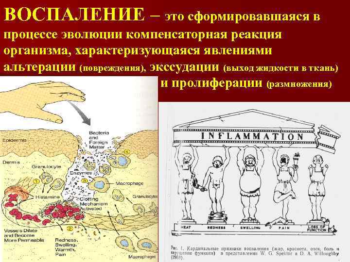 ВОСПАЛЕНИЕ – это сформировавшаяся в процессе эволюции компенсаторная реакция организма, характеризующаяся явлениями альтерации (повреждения),