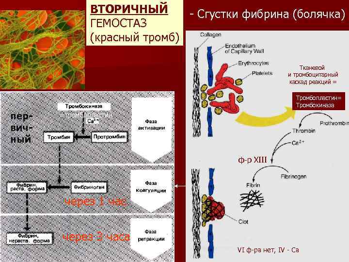 ВТОРИЧНЫЙ - Сгустки фибрина (болячка) ГЕМОСТАЗ (красный тромб) Тканевой и тромбоцитарный каскад реакций =