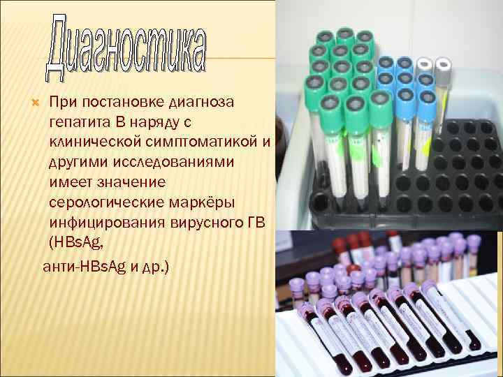  При постановке диагноза гепатита В наряду с клинической симптоматикой и другими исследованиями имеет
