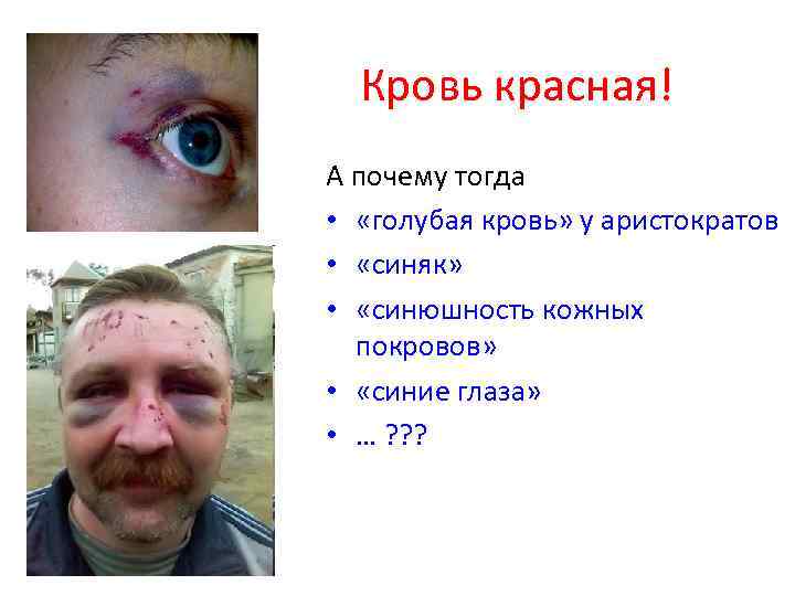 Кровь красная! А почему тогда • «голубая кровь» у аристократов • «синяк» • «синюшность