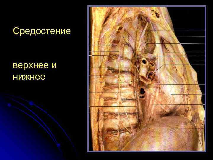 Средостение верхнее и нижнее 