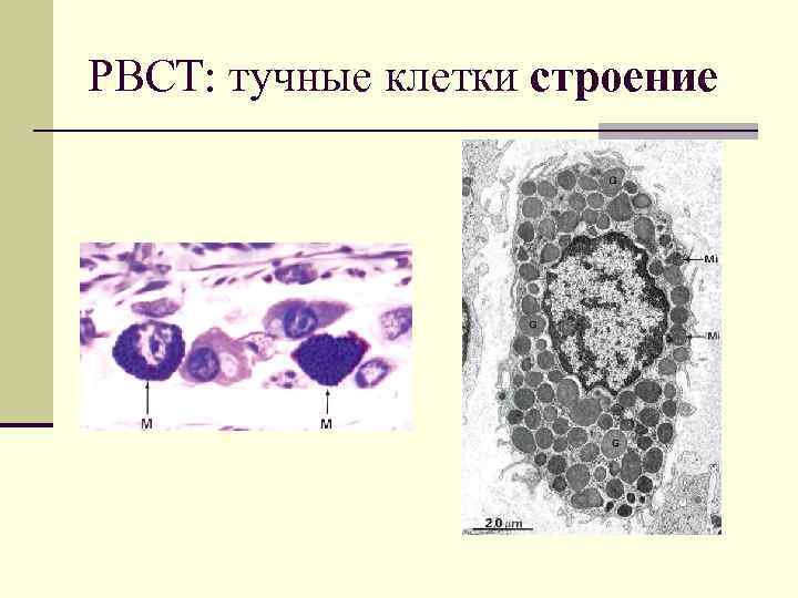 РВСТ: тучные клетки строение 