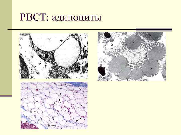 РВСТ: адипоциты 