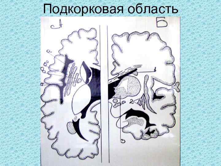 Подкорковая область 