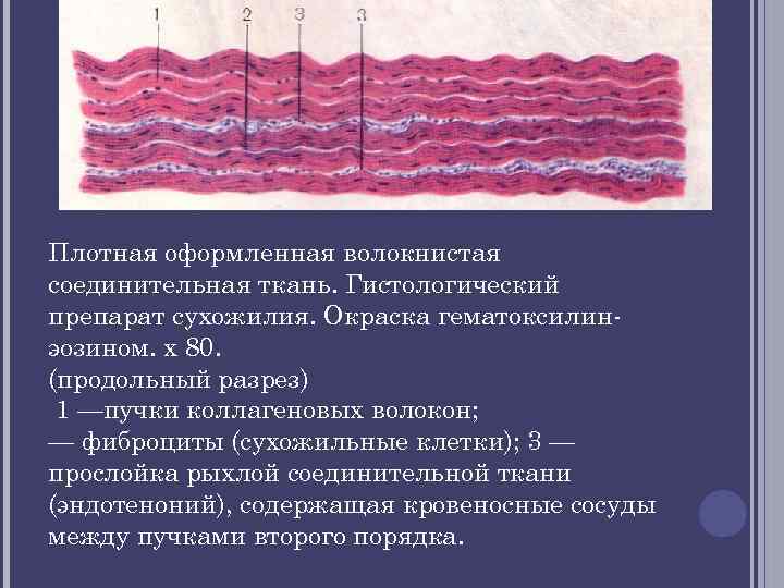 Соединительная ткань гистология презентация