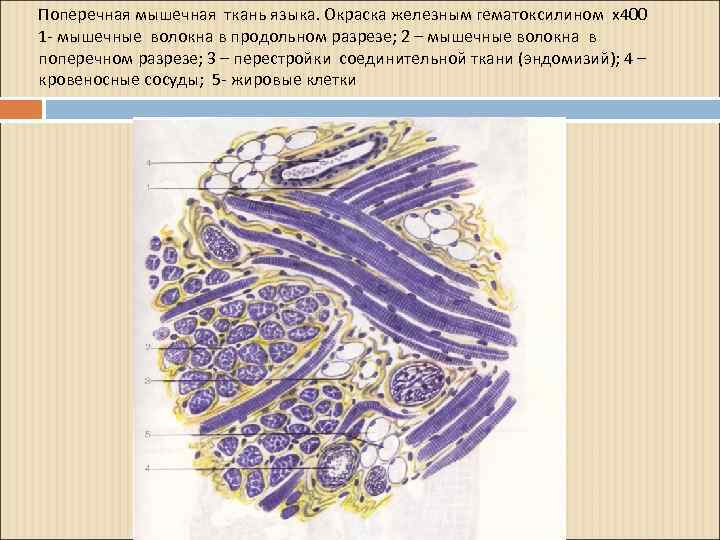 Пользуясь учебником определите где на рисунках изображены поперечно полосатые мышечные волокна а где