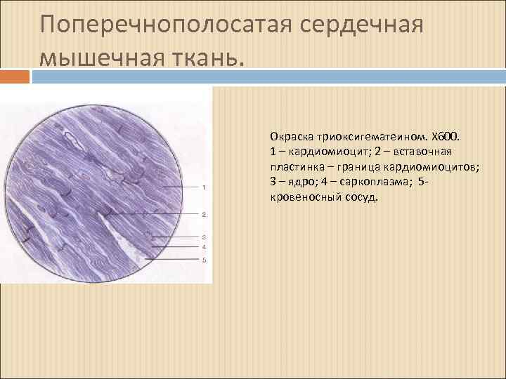 Сердечная поперечнополосатая мышечная ткань рисунок