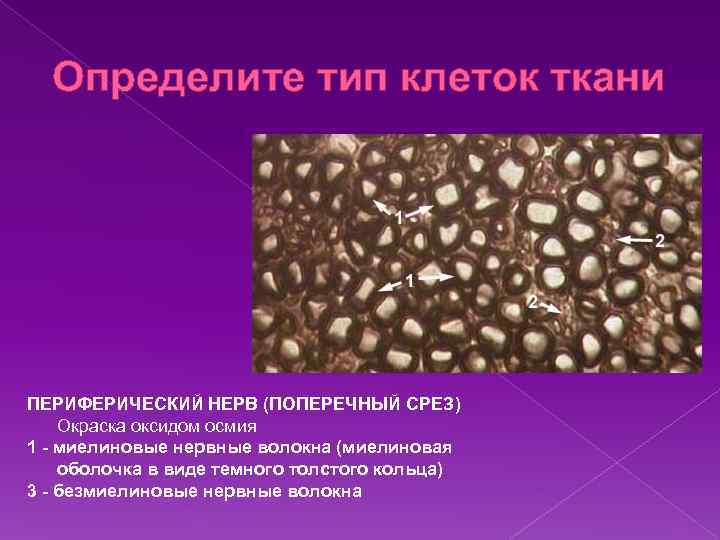 Определите тип клеток ткани ПЕРИФЕРИЧЕСКИЙ НЕРВ (ПОПЕРЕЧНЫЙ СРЕЗ) Окраска оксидом осмия 1 - миелиновые