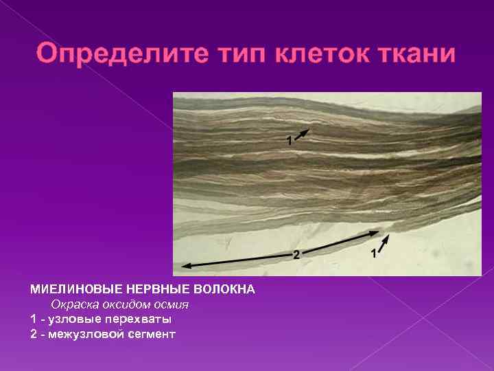 Определите тип клеток ткани МИЕЛИНОВЫЕ НЕРВНЫЕ ВОЛОКНА Окраска оксидом осмия 1 - узловые перехваты