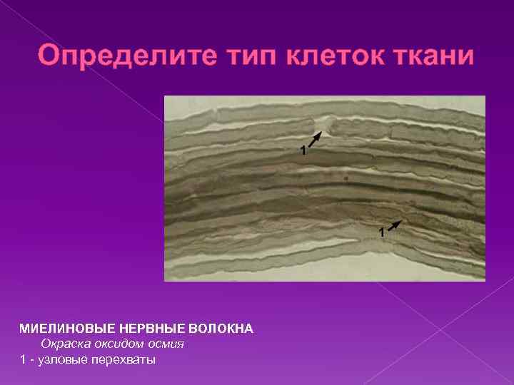 Определите тип клеток ткани МИЕЛИНОВЫЕ НЕРВНЫЕ ВОЛОКНА Окраска оксидом осмия 1 - узловые перехваты