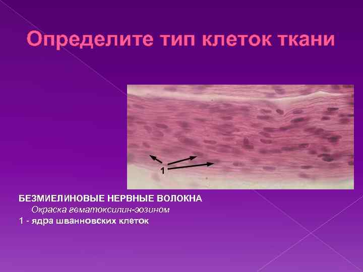 Определите тип клеток ткани БЕЗМИЕЛИНОВЫЕ НЕРВНЫЕ ВОЛОКНА Окраска гематоксилин-эозином 1 - ядра шванновских клеток