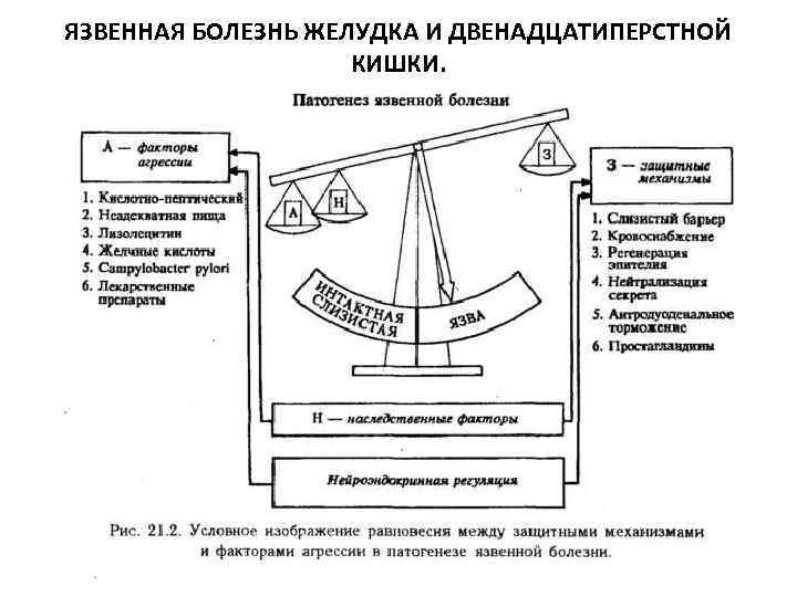 ЯЗВЕННАЯ БОЛЕЗНЬ ЖЕЛУДКА И ДВЕНАДЦАТИПЕРСТНОЙ КИШКИ. 