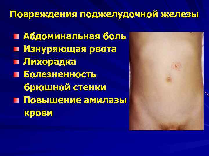 Повреждения поджелудочной железы Абдоминальная боль Изнуряющая рвота Лихорадка Болезненность брюшной стенки Повышение амилазы крови