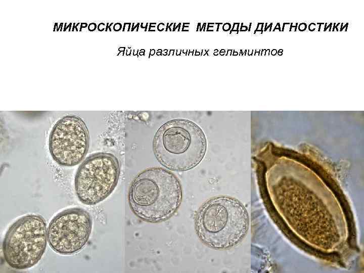 МИКРОСКОПИЧЕСКИЕ МЕТОДЫ ДИАГНОСТИКИ Яйца различных гельминтов 