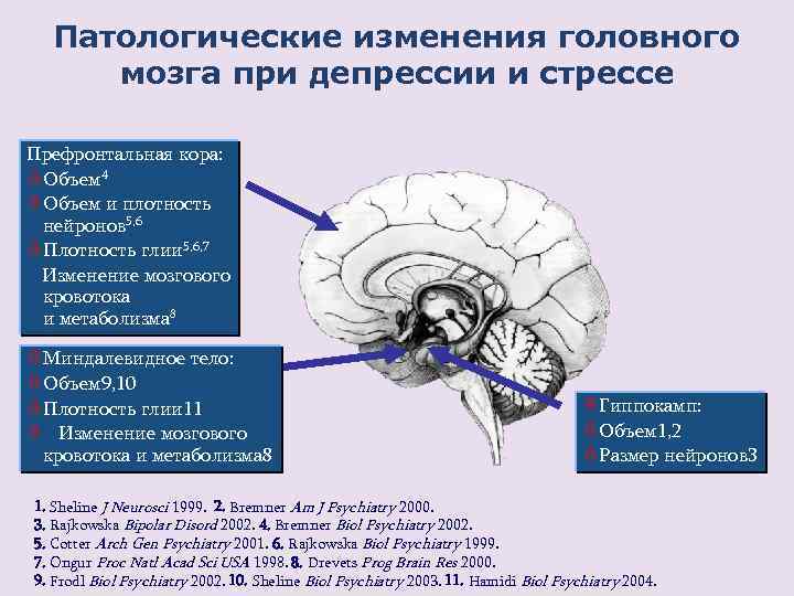 Стрессы головной мозг. Патологические процессы в головном мозге. Изменение структуры мозга.
