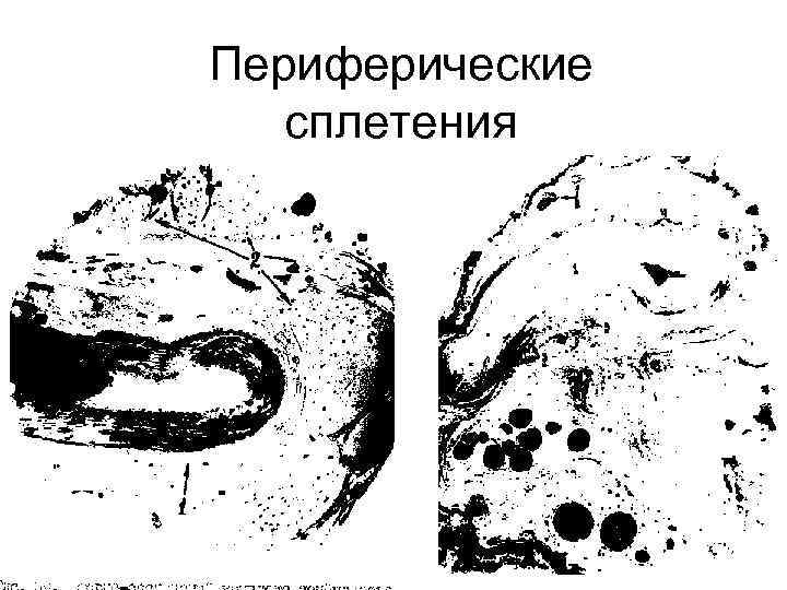 Периферические сплетения 