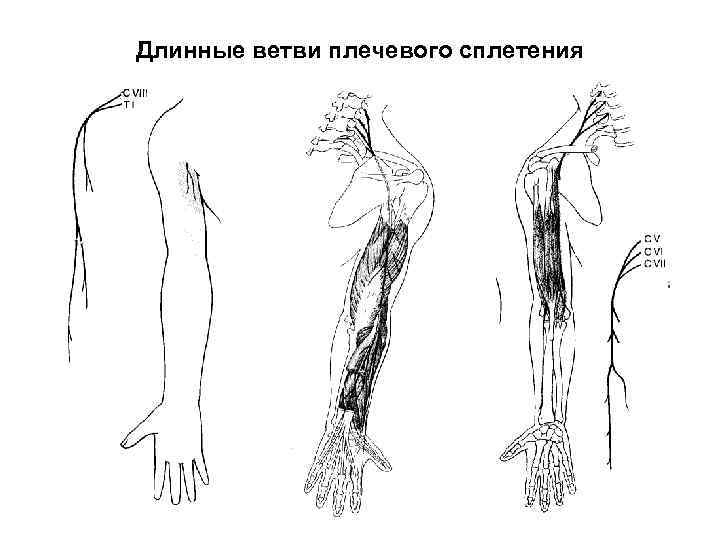 Плечевое сплетение рисунок