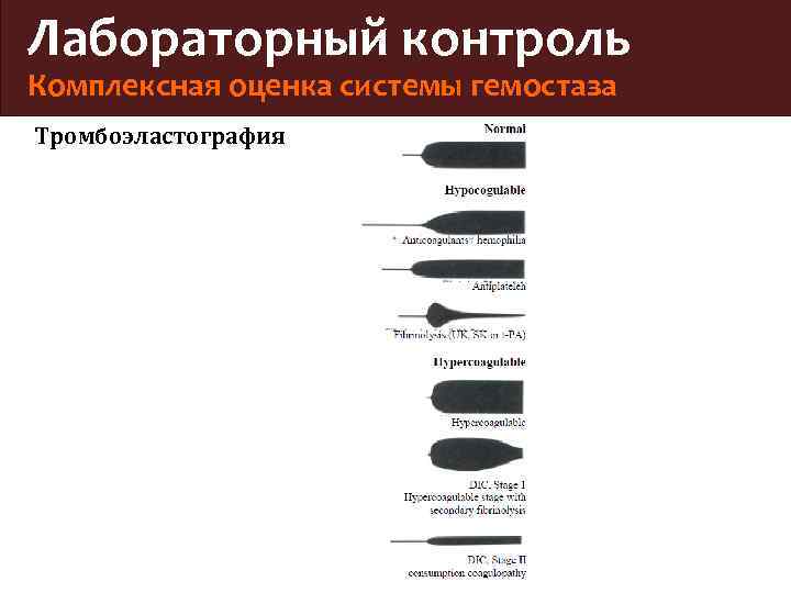 Лабораторный контроль Комплексная оценка системы гемостаза Тромбоэластография 
