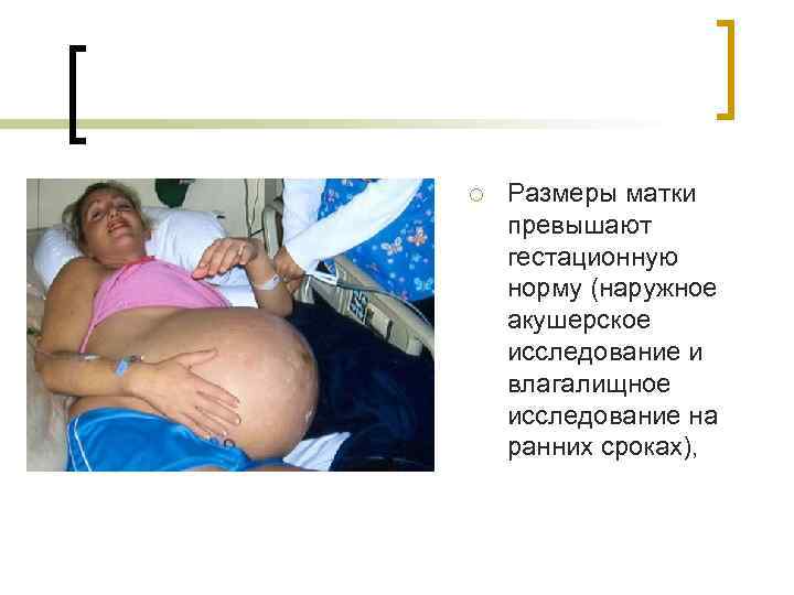 ¡ Размеры матки превышают гестационную норму (наружное акушерское исследование и влагалищное исследование на ранних