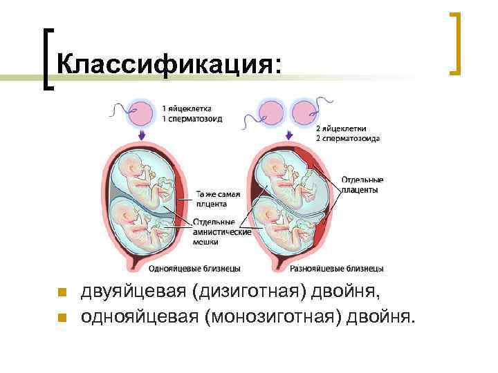 Классификация: n n двуяйцевая (дизиготная) двойня, однояйцевая (монозиготная) двойня. 