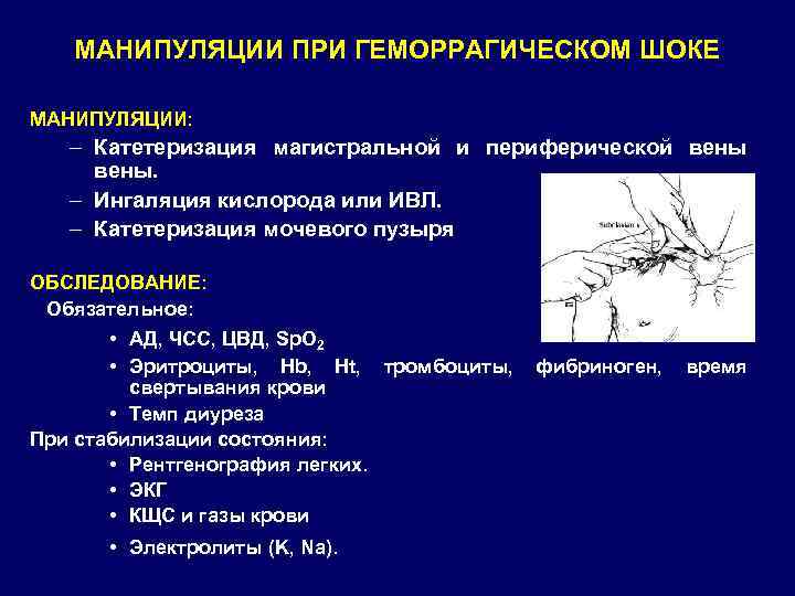 МАНИПУЛЯЦИИ ПРИ ГЕМОРРАГИЧЕСКОМ ШОКЕ МАНИПУЛЯЦИИ: – Катетеризация магистральной и периферической вены. – Ингаляция кислорода