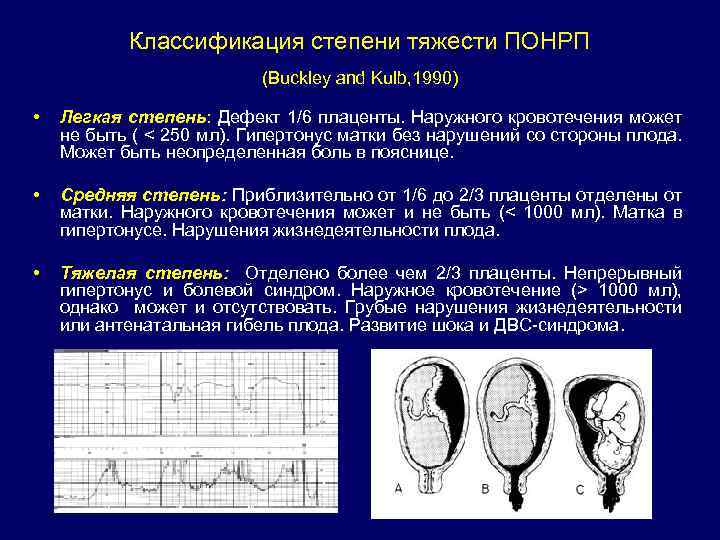 Классификация степени тяжести ПОНРП (Buckley and Kulb, 1990) • Легкая степень: Дефект 1/6 плаценты.