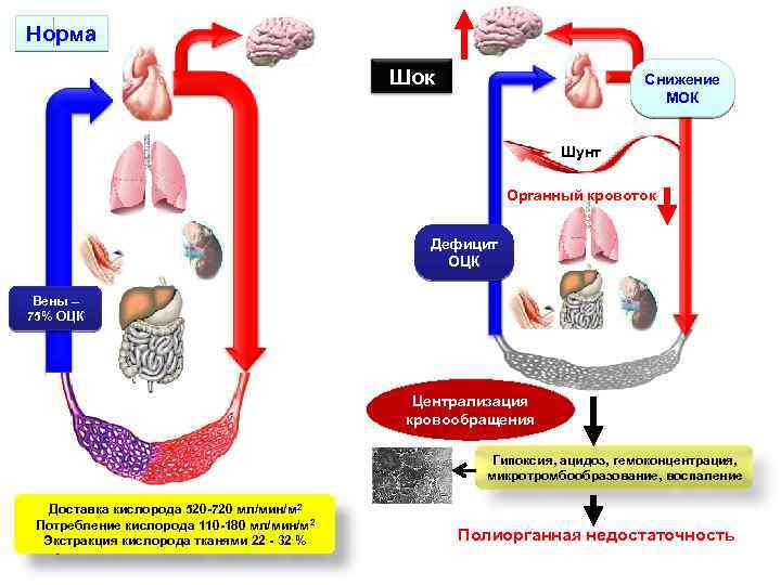Норма Шок Снижение МОК Шунт Органный кровоток Дефицит ОЦК Вены – 75% ОЦК Централизация