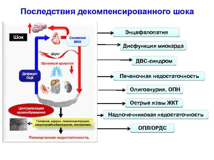 Последствия декомпенсированного шока Энцефалопатия Дисфункция миокарда ДВС-синдром Печеночная недостаточность Олигоанурия, ОПН Острые язвы ЖКТ