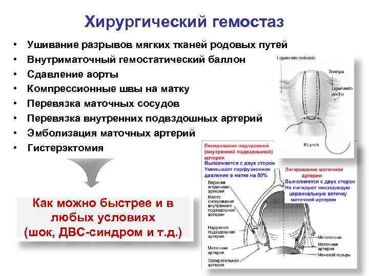 Баллонная тампонада матки презентация