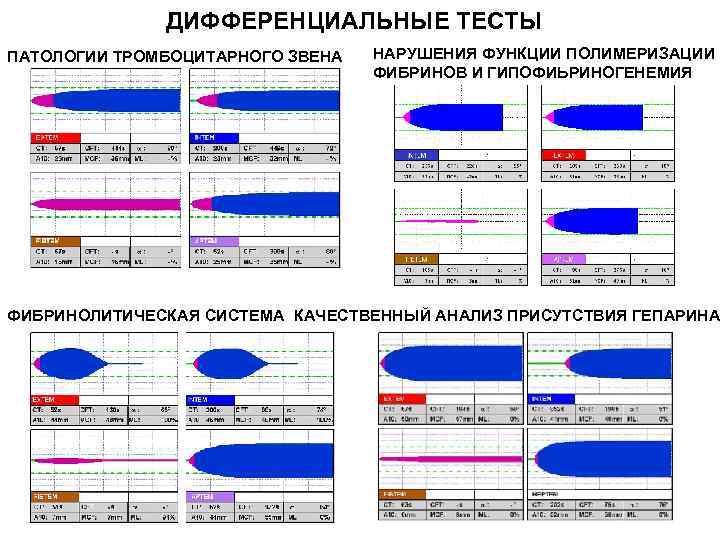 ДИФФЕРЕНЦИАЛЬНЫЕ ТЕСТЫ ПАТОЛОГИИ ТРОМБОЦИТАРНОГО ЗВЕНА НАРУШЕНИЯ ФУНКЦИИ ПОЛИМЕРИЗАЦИИ ФИБРИНОВ И ГИПОФИЬРИНОГЕНЕМИЯ ФИБРИНОЛИТИЧЕСКАЯ СИСТЕМА КАЧЕСТВЕННЫЙ