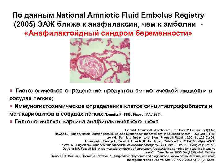 По данным National Amniotic Fluid Embolus Registry (2005) ЭАЖ ближе к анафилаксии, чем к