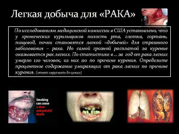 Легкая добыча для «РАКА» По исследованиям медицинской комиссии в США установлено, что у хронических