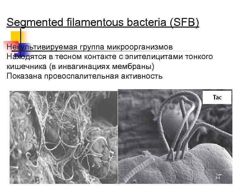 Segmented filamentous bacteria (SFB) Некультивируемая группа микроорганизмов Находятся в тесном контакте с эпителицитами тонкого