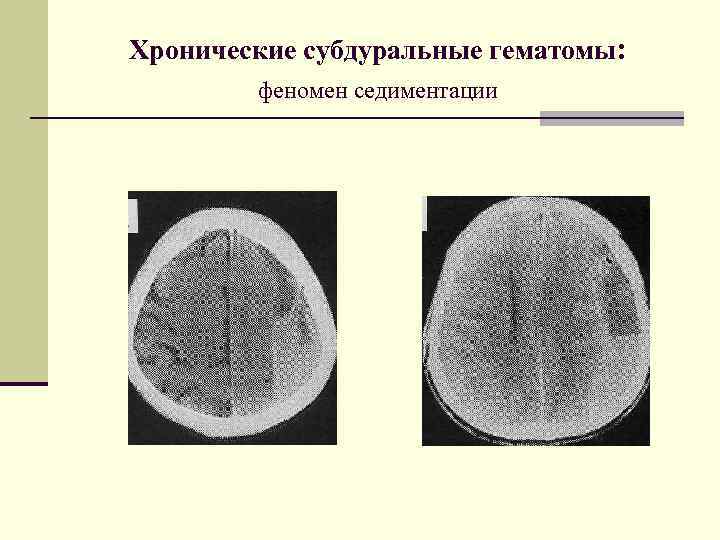 Черепно мозговая травма карта вызова скорой