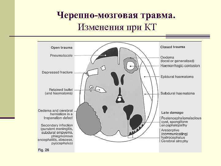 Черепно-мозговая травма. Изменения при КТ 