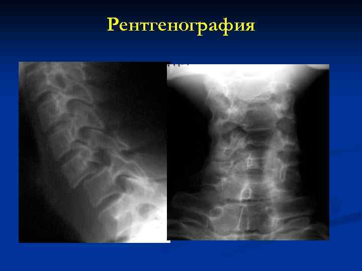 Рентгенография 