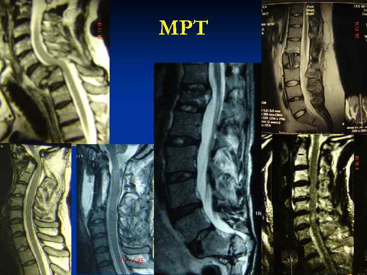 МРТ 