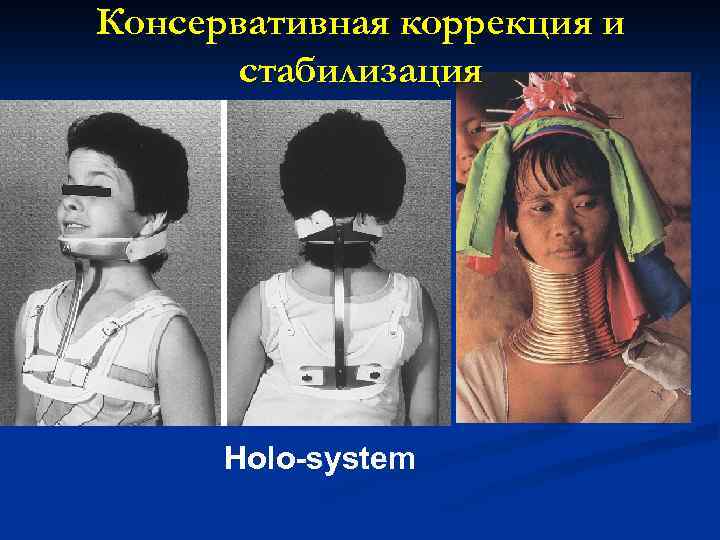 Консервативная коррекция и стабилизация Holo-system 