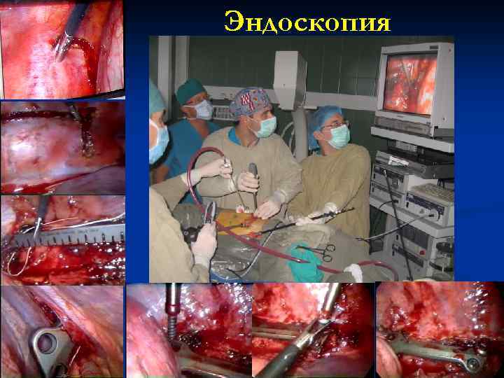 Эндоскопия 