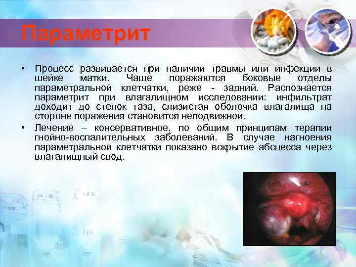 Параметрит • Процесс развивается при наличии травмы или инфекции в шейке матки. Чаще поражаются