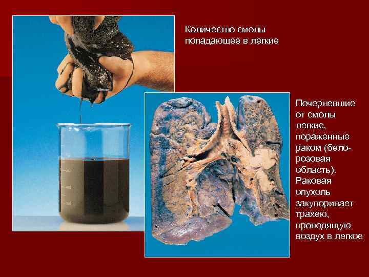 Количество смолы попадающее в легкие Почерневшие от смолы легкие, пораженные раком (бело розовая область).