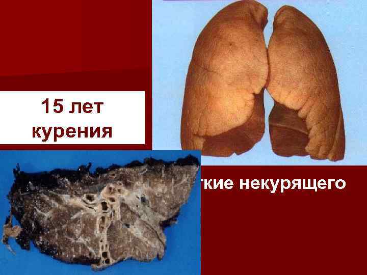15 лет курения Легкие некурящего 