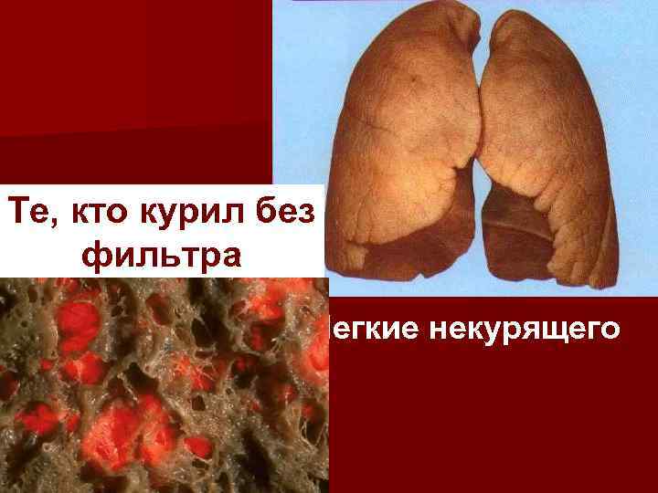 Те, кто курил без фильтра Легкие некурящего 