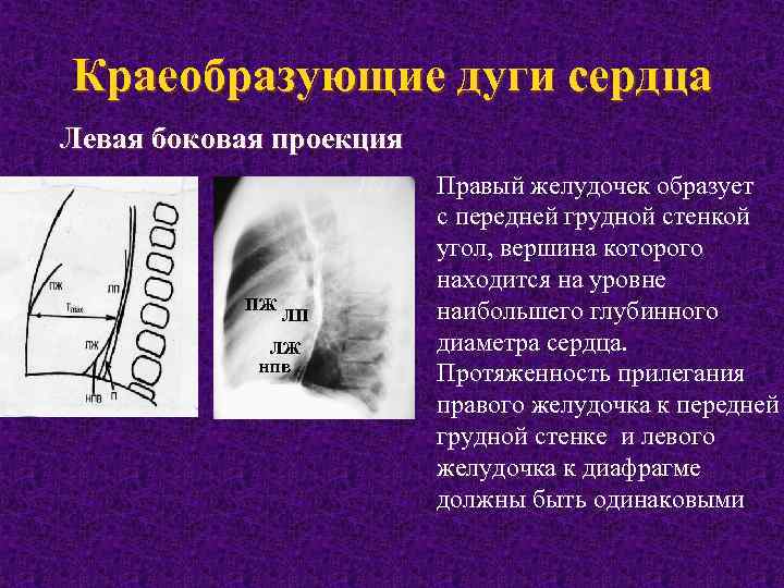 Краеобразующие дуги сердца Левая боковая проекция ПЖ ЛП ЛЖ нпв Правый желудочек образует с