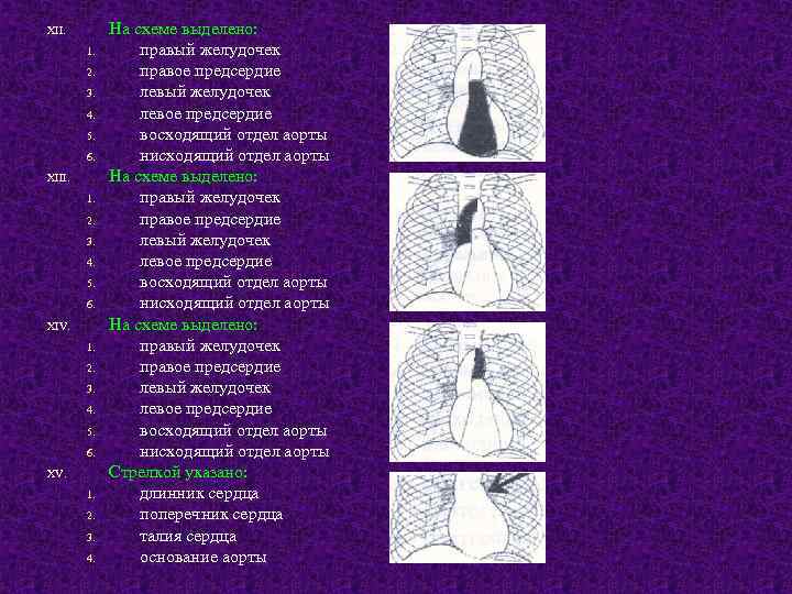 XII. 1. 2. 3. 4. 5. 6. XIV. 1. 2. 3. 4. 5. 6.