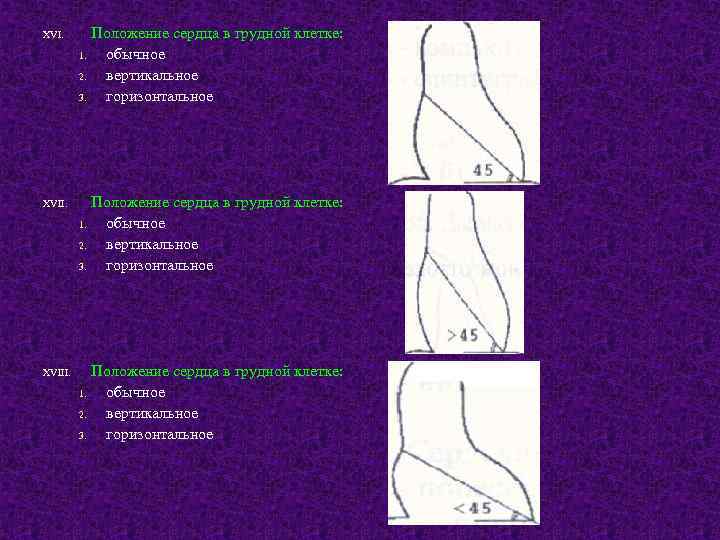 Положение сердца. Вертикальное положение сердца. Горизонтальное положение сердца. Вертикальная позиция сердца. Рентгеноанатомия сердца и крупных сосудов.