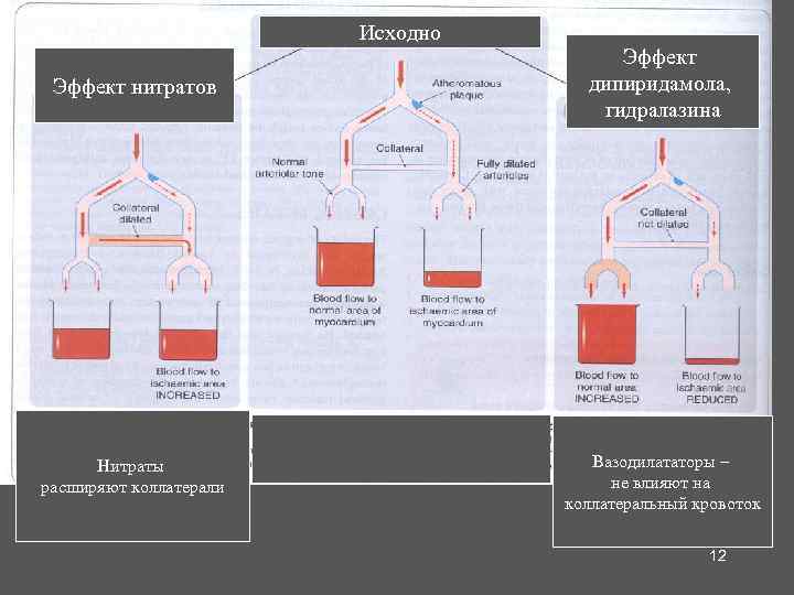 Исходно Эффект нитратов Эффект дипиридамола, гидралазина Нитраты расширяют коллатерали Вазодилататоры – не влияют на