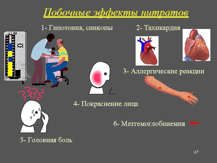 Побочные эффекты нитратов 1 - Гипотония, синкопы 2 - Тахикардия 3 - Аллергические реакции